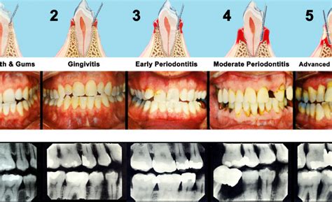 gum disease doctor near me.